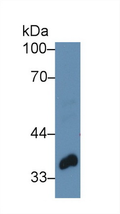 9215