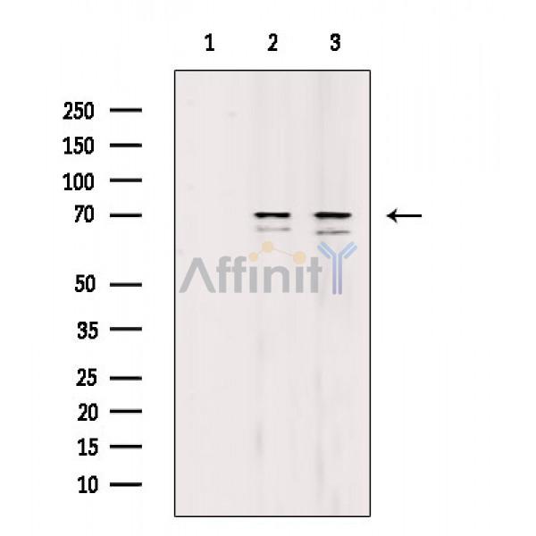 Валидация Affinity DF6913 - 18511