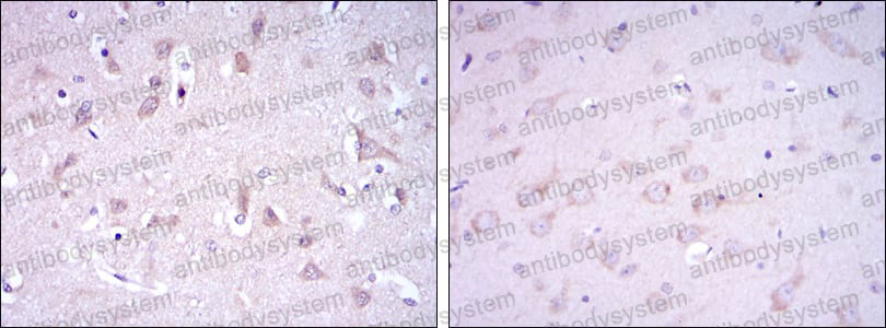 Валидация AntibodySystem RHE34801