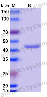 Валидация SDS-PAGE - AntibodySystem RVV13412