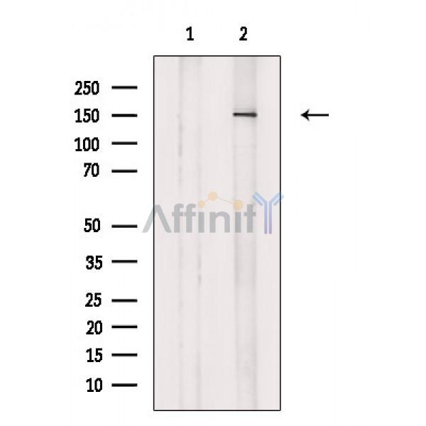 Валидация Affinity DF2419 - 13020