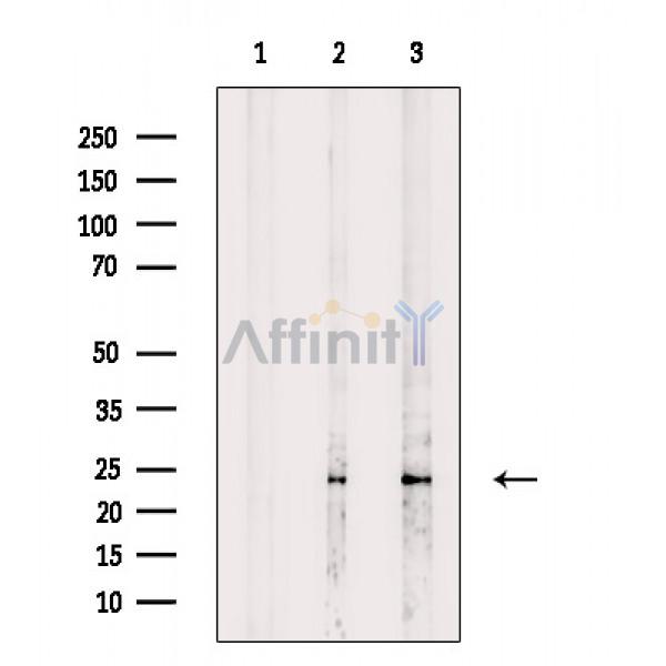 Валидация Affinity DF8537 - 20416