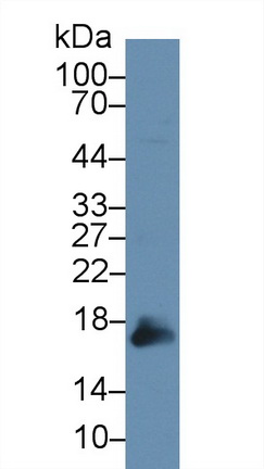 14746
