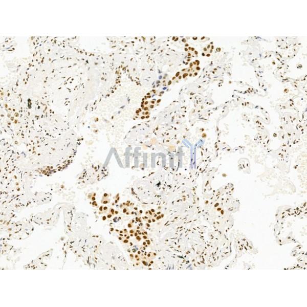Валидация Affinity DF13625 - 9150