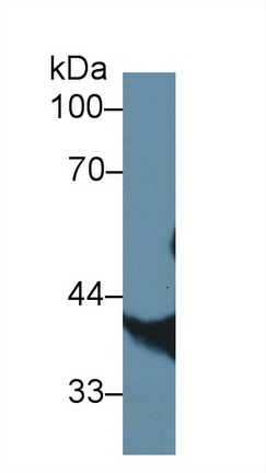 14595