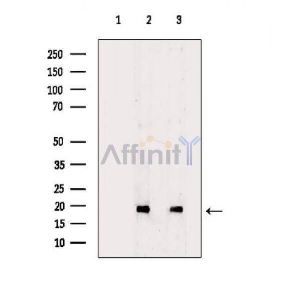 Валидация Affinity DF8536 - 20414
