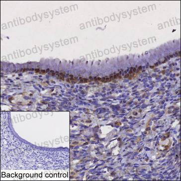 Валидация AntibodySystem RHP06002
