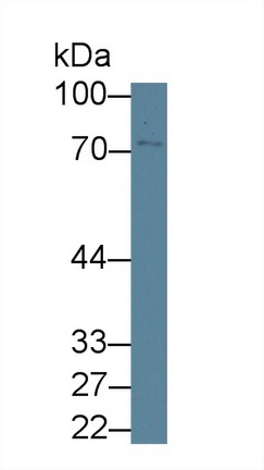 12538