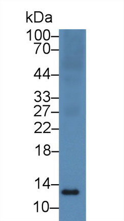 13952