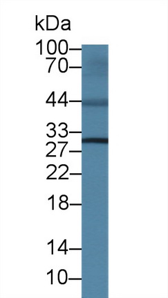 14391