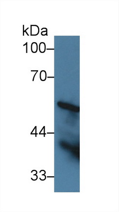 14272