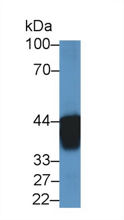 12617