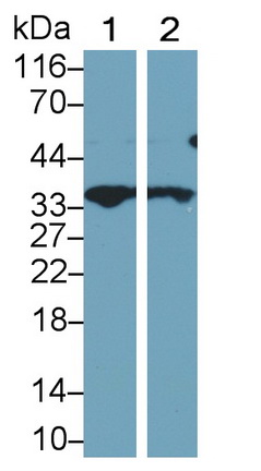 26076