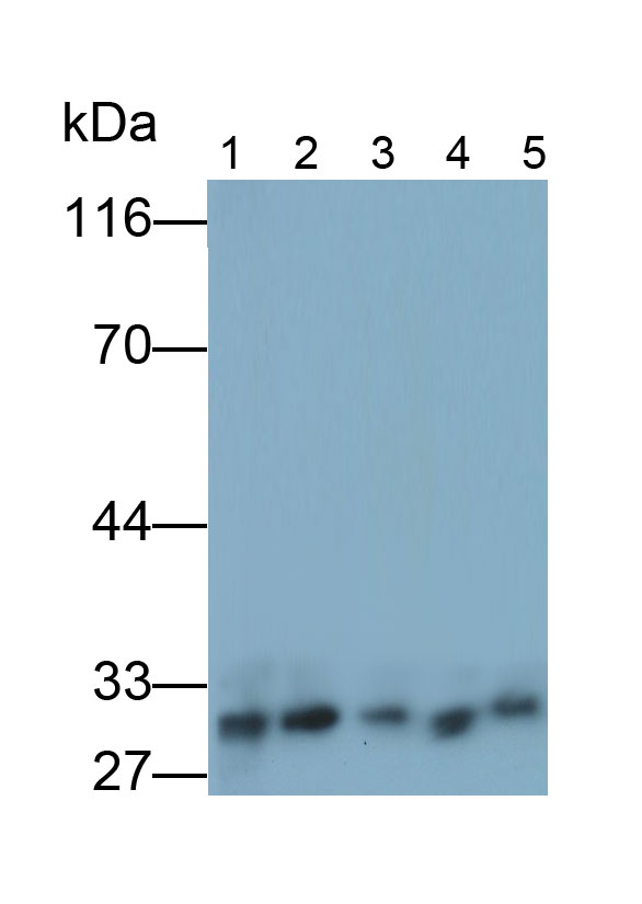 5945