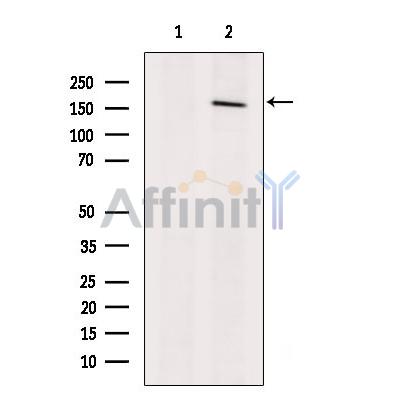 Валидация Affinity DF8544 - 20431