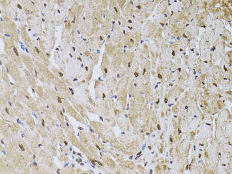 A13938, иммуногистохимия, сердце крысы (6026)
