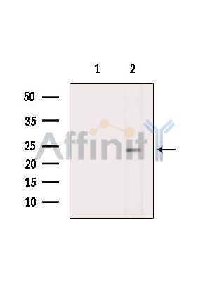 Валидация Affinity DF14541 - 10532