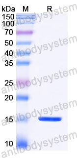 Валидация SDS-PAGE - AntibodySystem RZZ01821