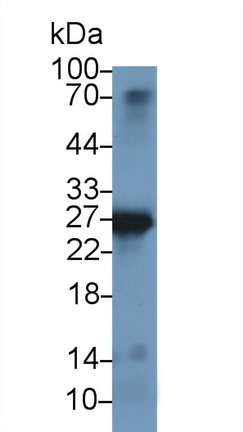 13818