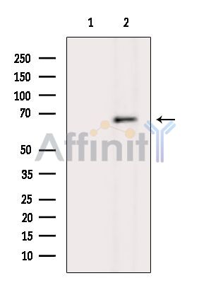 Валидация Affinity DF15814 - 12303