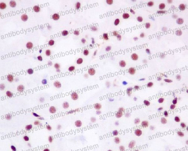 Валидация AntibodySystem RHB03303