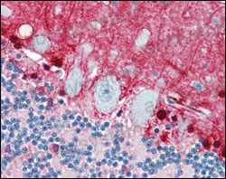 Валидация AntibodySystem RHC08406 (604)