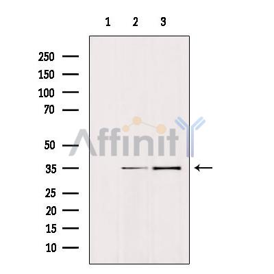 Валидация Affinity DF6311 - 17635
