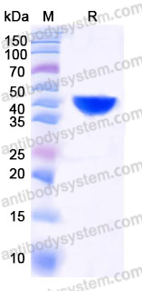 YHE28102, SDS-PAGE