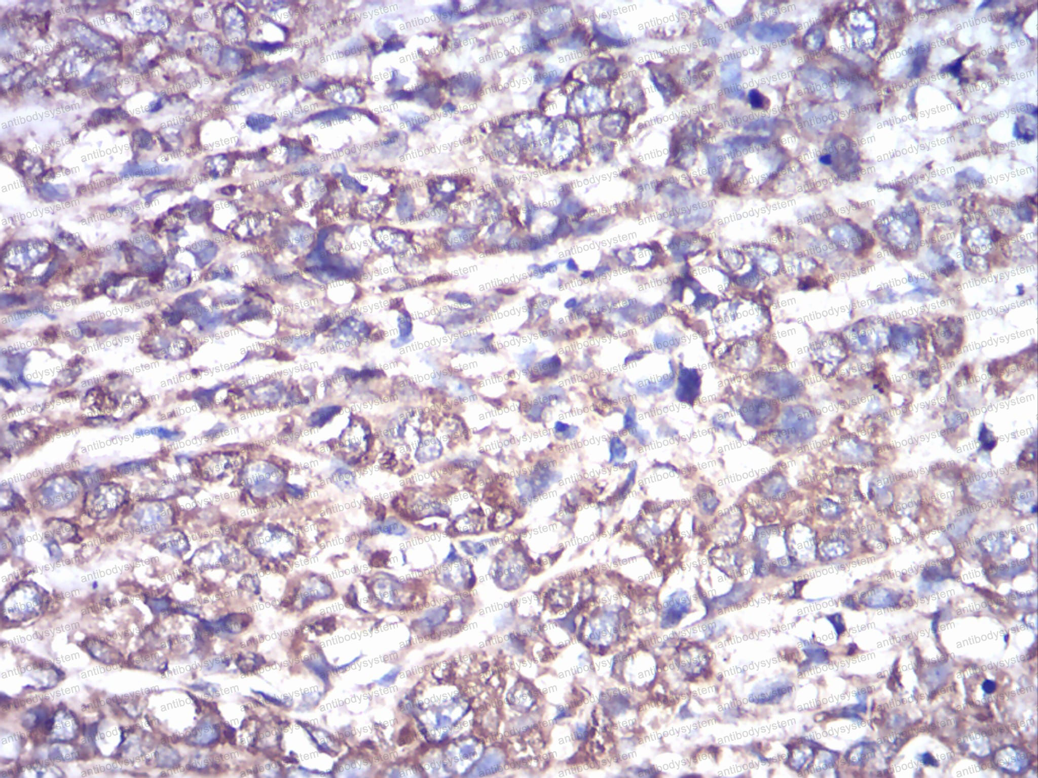 Валидация AntibodySystem RHF56801