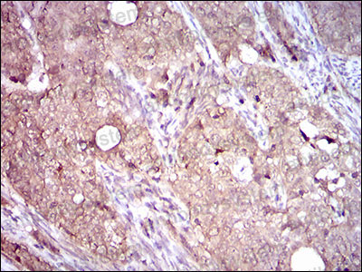 Валидация AntibodySystem RHD15402 (1367)