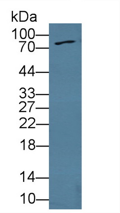 11991