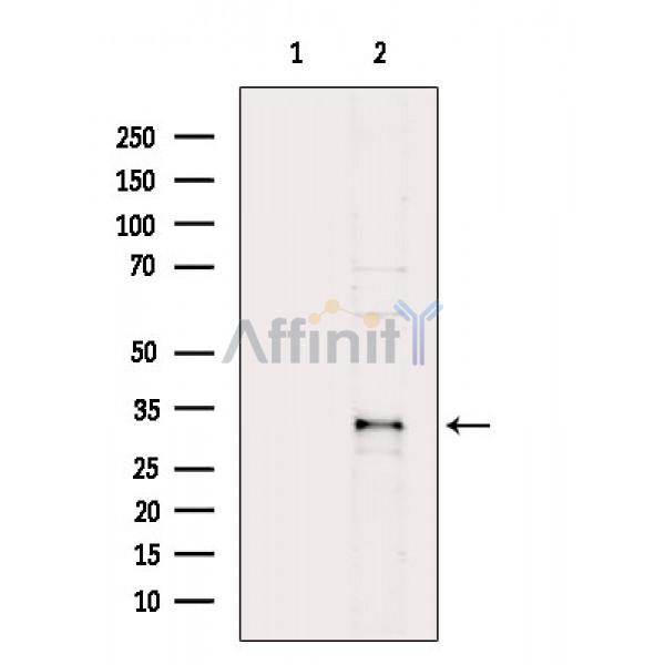 Валидация Affinity DF8573 - 20475