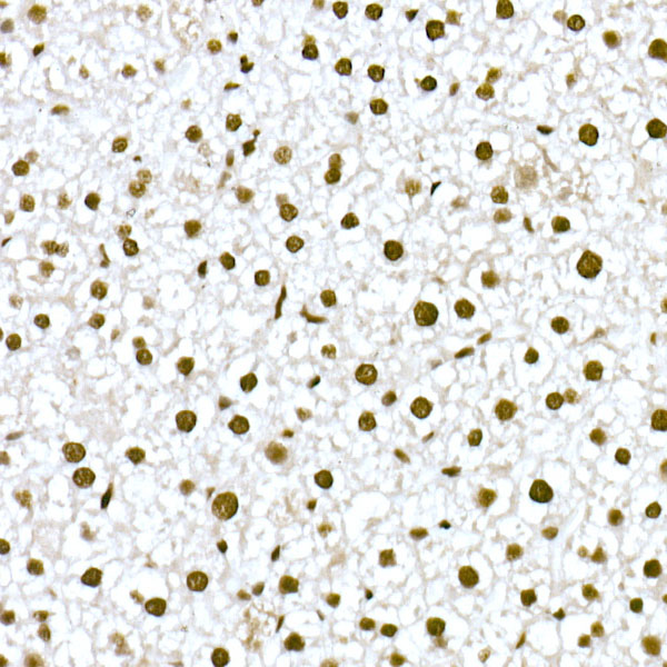 A21133, иммуногистохимия, парафиновые срезы печени мыши (16601)