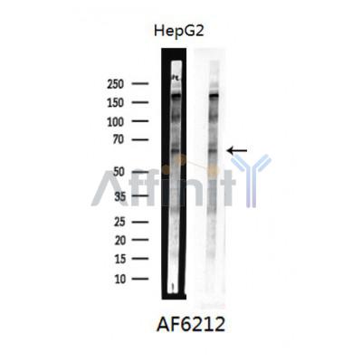 Валидация Affinity AF6212 - 3453