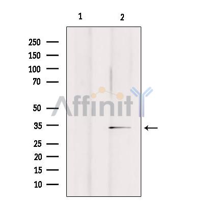 Валидация Affinity DF8690 - 20670