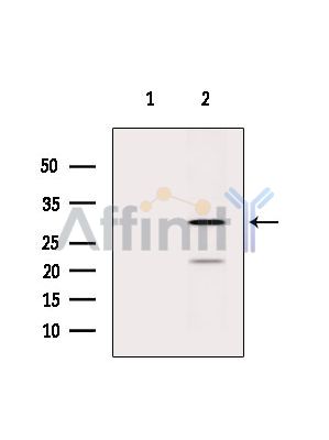 Валидация Affinity DF6425 - 17796