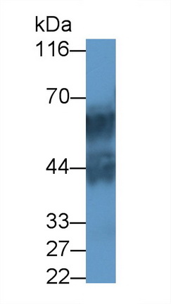 22161