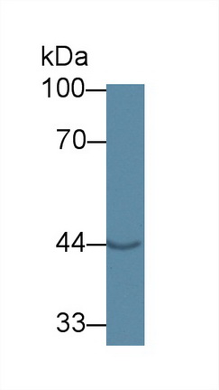 14160