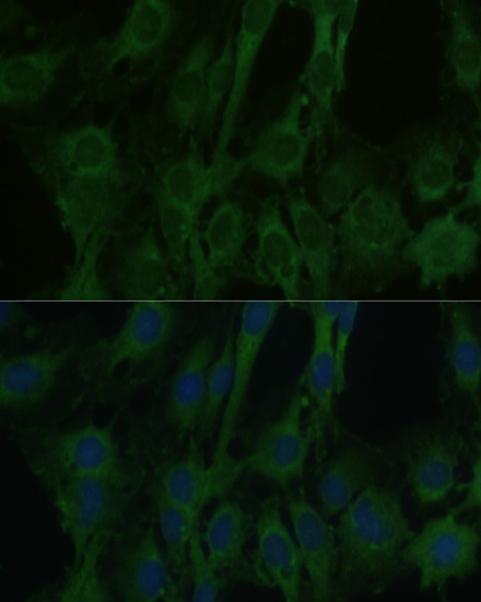 A11604, иммунофлуоресценция, клетки C6 (2374)