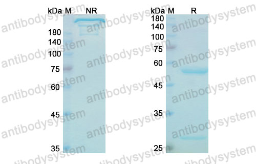 Валидация SDS-PAGE - AntibodySystem DHF32701