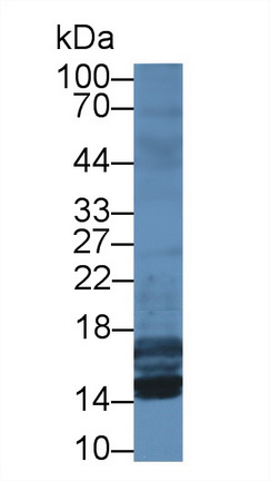 25451