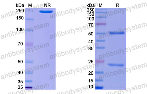 Валидация SDS-PAGE - AntibodySystem FFJ92810