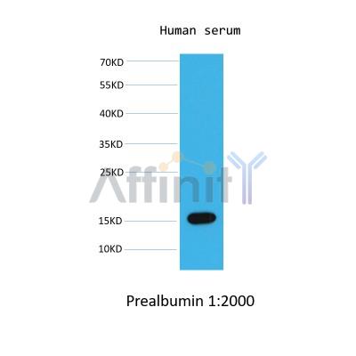 Валидация Affinity BF0713 - 5385