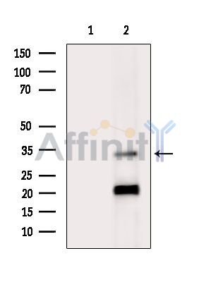 Валидация Affinity DF13929 - 9675