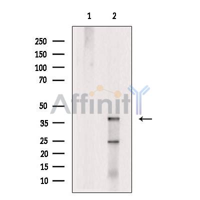 Валидация Affinity DF13633 - 9170