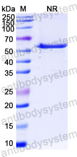 Валидация SDS-PAGE - AntibodySystem DHD37504