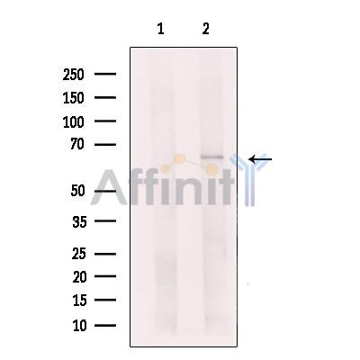 Валидация Affinity DF13657 - 9217