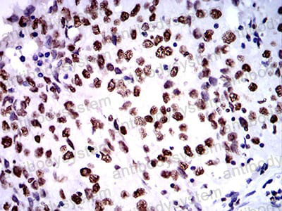 Валидация AntibodySystem RHN95901 (3997)
