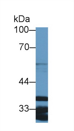 14466