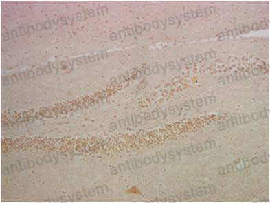 Валидация AntibodySystem RHG01006